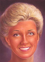 Chemical Peel 5 chemical peel 4